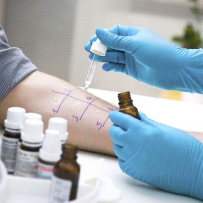 allergy-testing